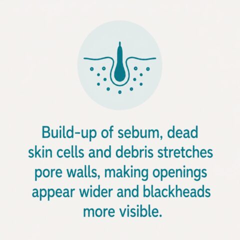Excess Sebum, Congestion and Blackheads