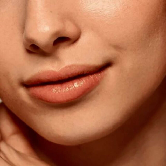 Lip Treatments in Noosaville on the Sunshine Coast: Restore lost volume, add soft pouty volume or redefine your lips with Lip Treatment